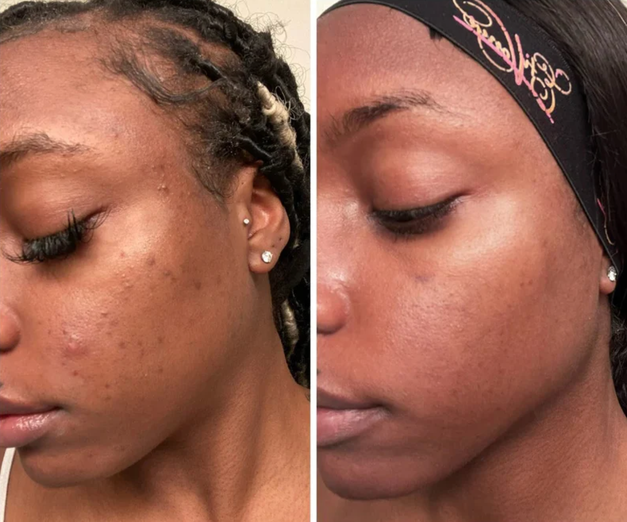 Tumeric & Kojic Acid Soap